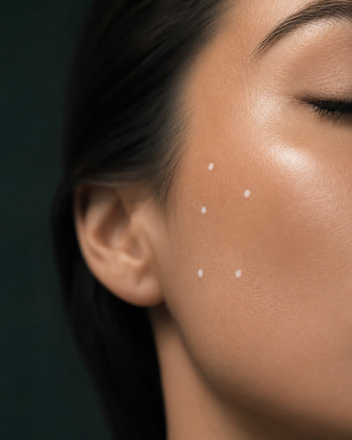 Skin boosters, editorial image