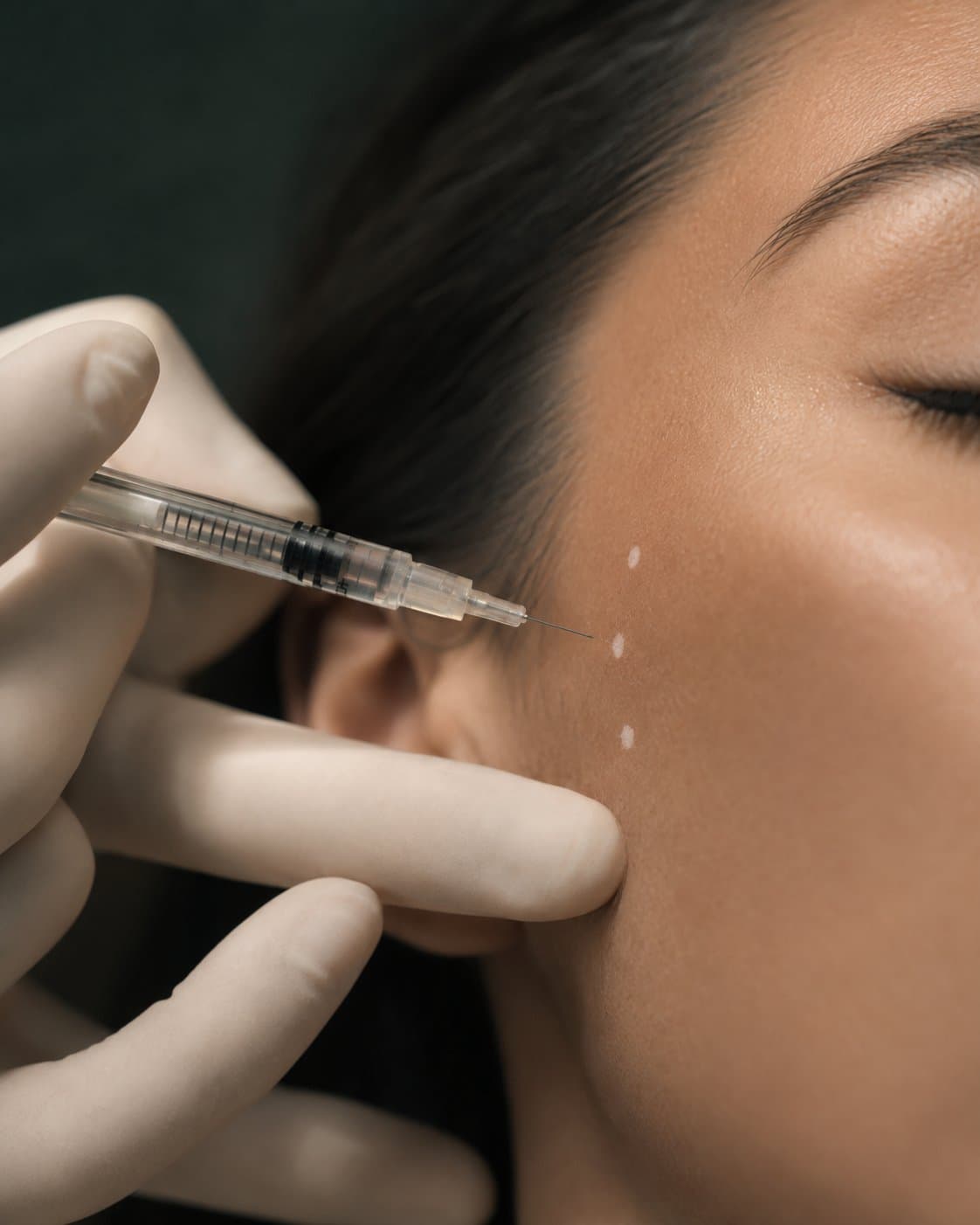 A filler syringe placed gently against a client's cheek
