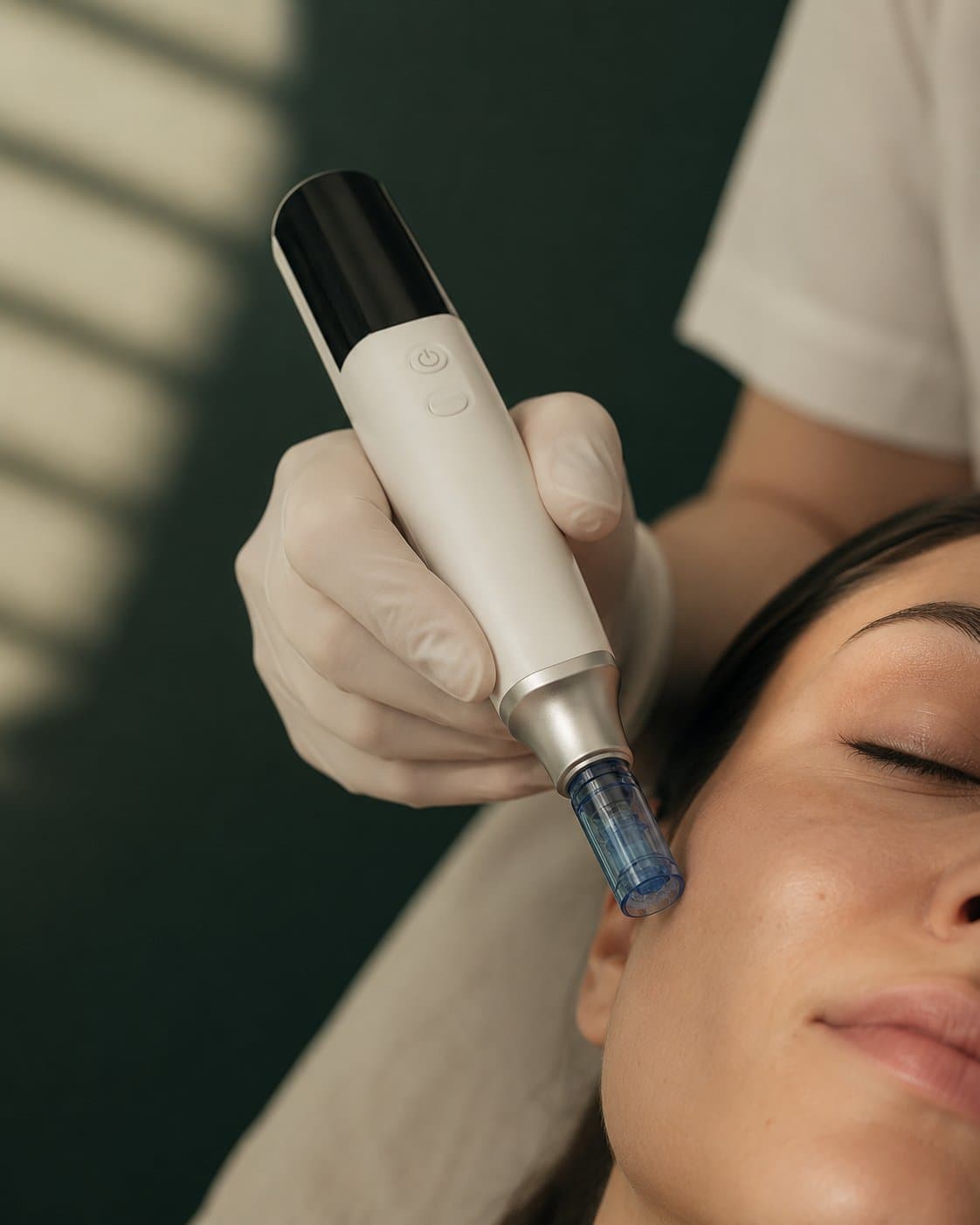 A microneedling pen guided across a client's forehead