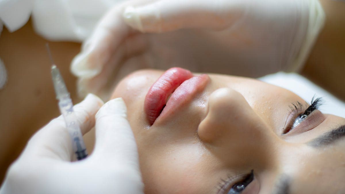 Dermal Fillers